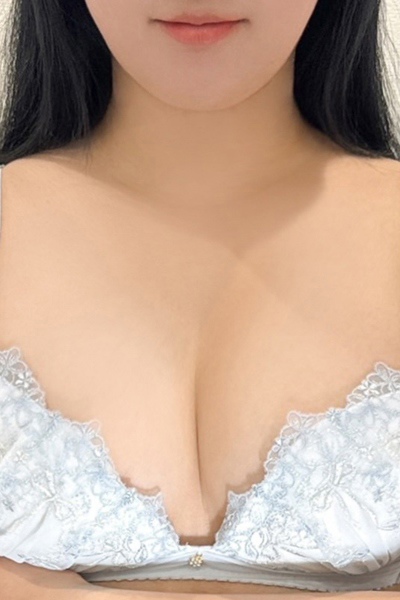 こあ